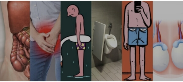 Prosatol Complex Nasıl Kullanılır – kullanım kqılavuzu ve dozaj Prosatol Complex Nasıl Kullanılır – kullanım kqılavuzu ve dozaj